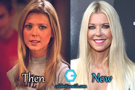 Tara Reid Before and After Plastic Surgery: Boobs,。